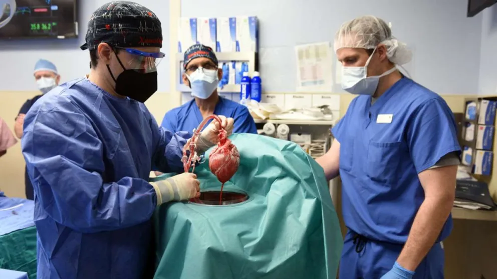 Murió el hombre que había sido trasplantado con el corazón de un cerdo 